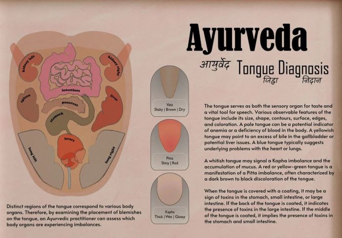 White Tongue? Yellow Tongue? Ayurveda Explains All